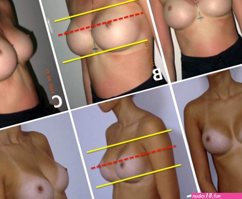 Metrics of the Aesthetically Perfect Breast