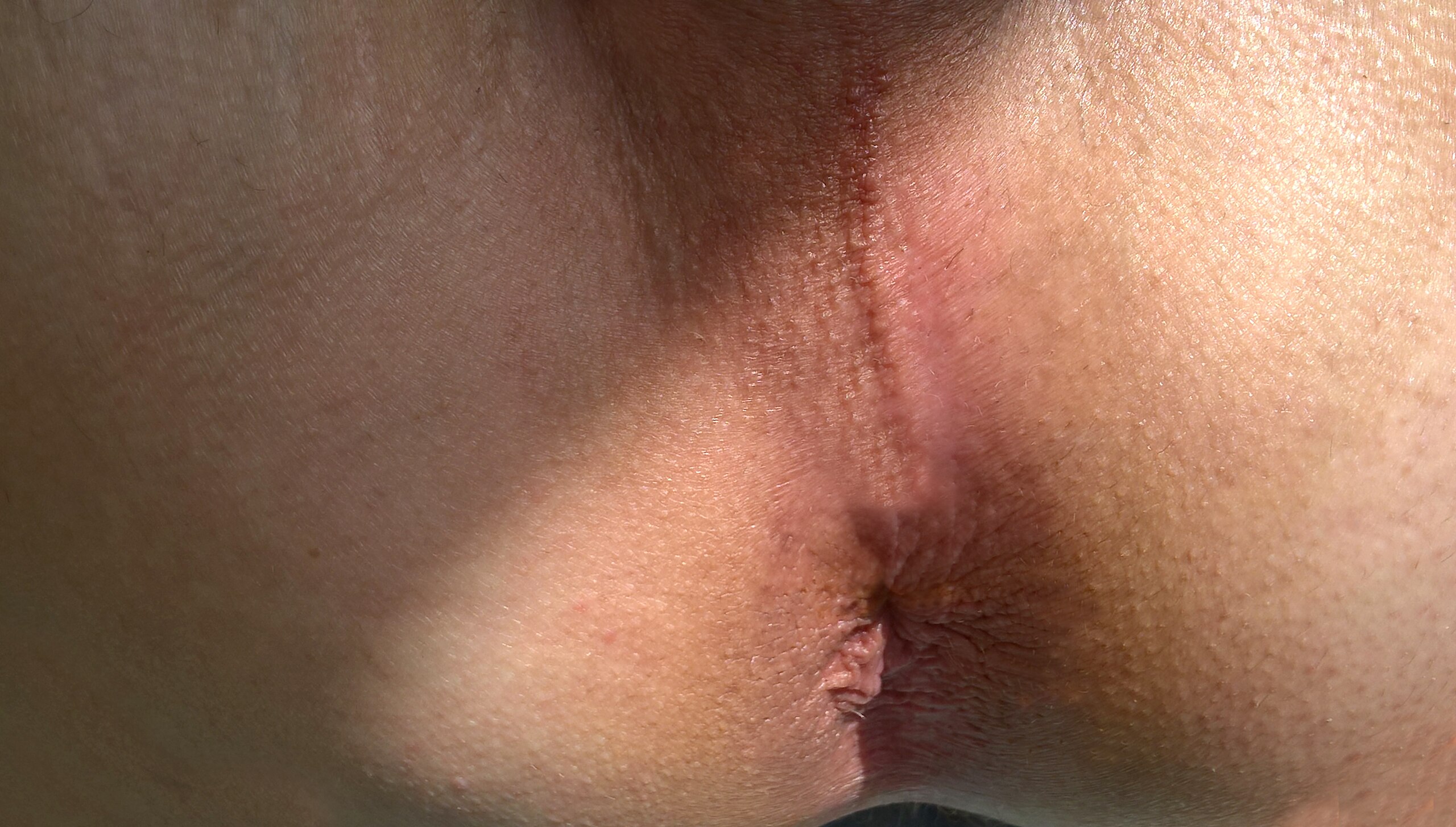 File:Shave testicles of a transgender
