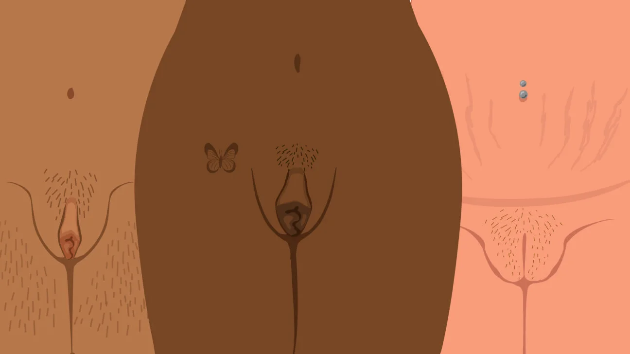 Lopsided Vagina: 9 Different Labia Shapes Colors and Sizes