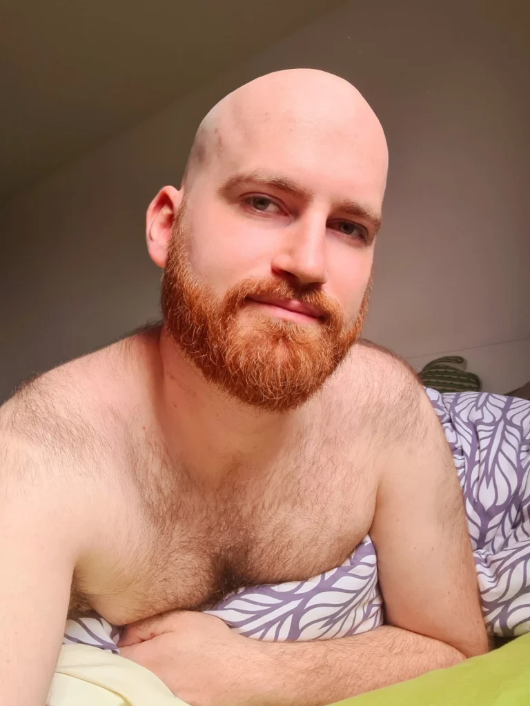 redfoxm OnlyFans