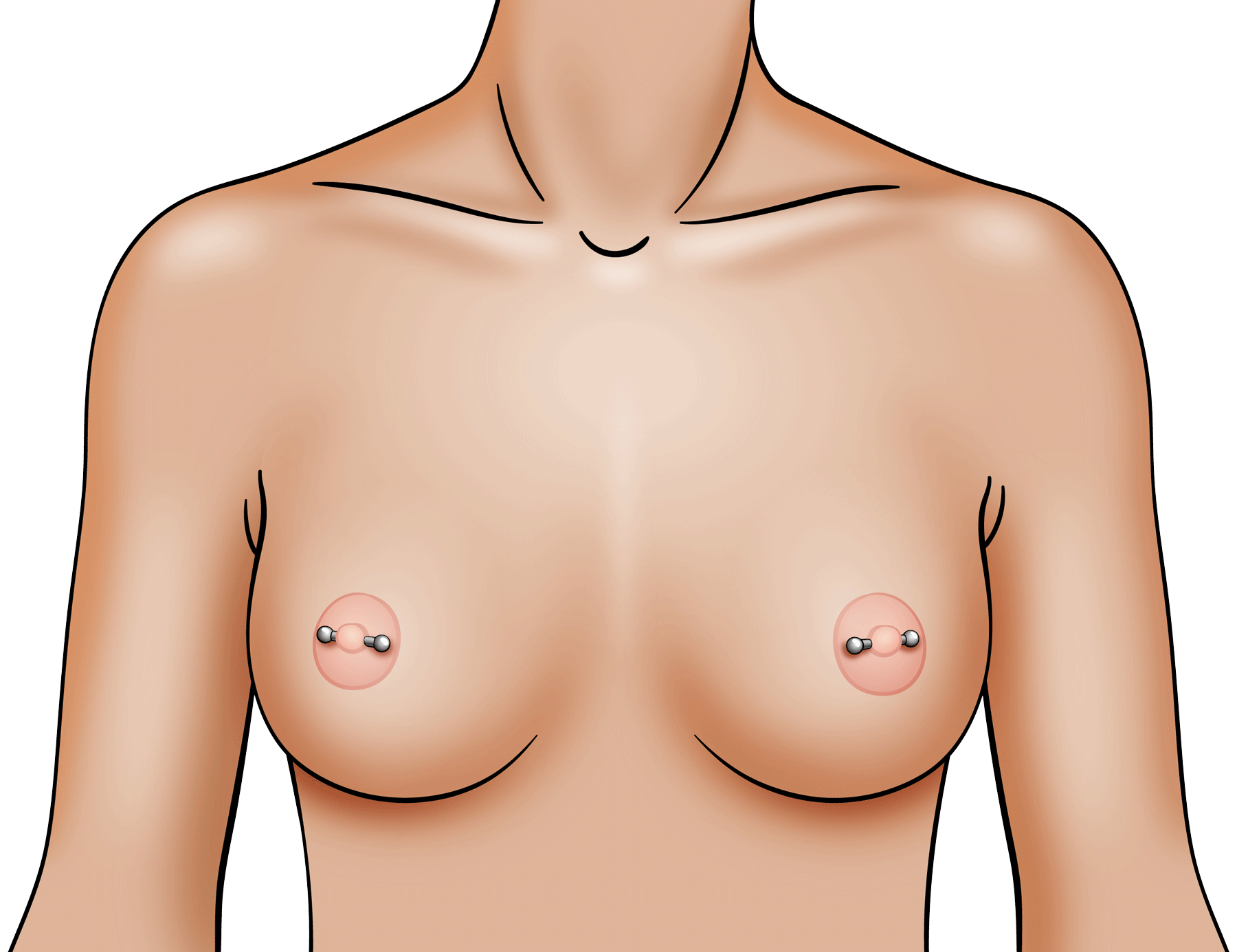 Nipple Piercings and Breast Implants