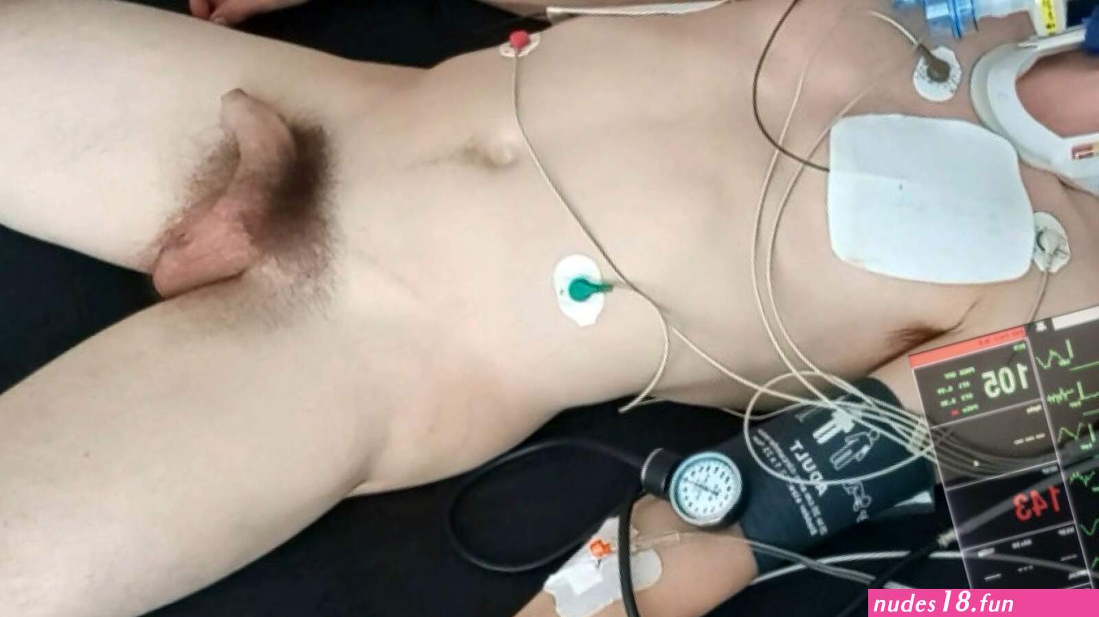 Resuscitation of a male patient reupload