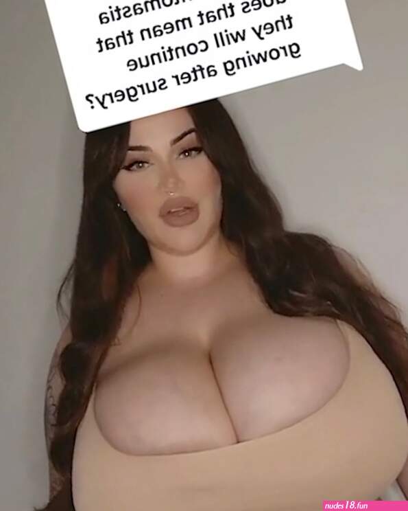 My giant boobs wont stop growing despite me shedding 30lb
