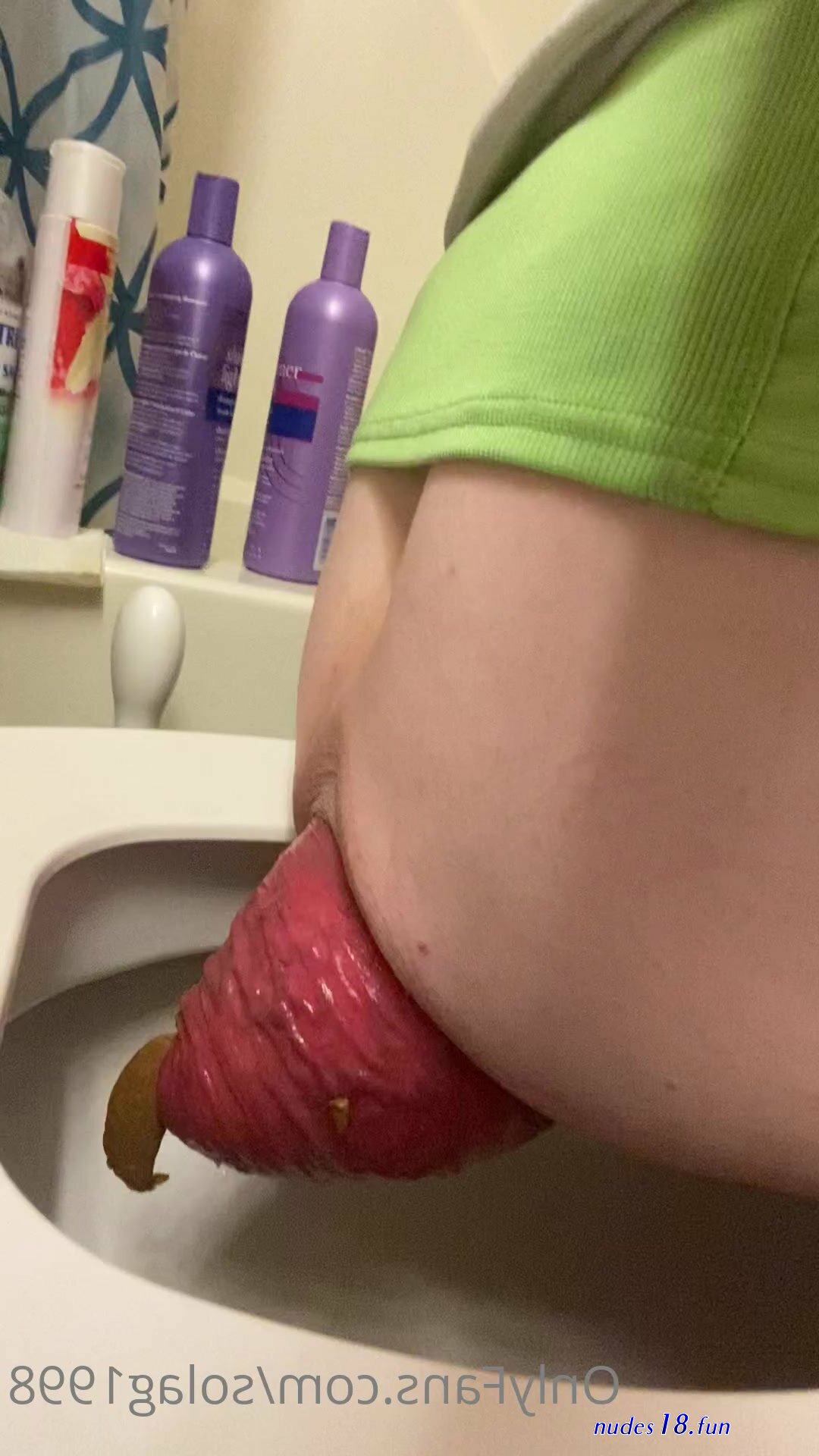 porn thisvid prolapse