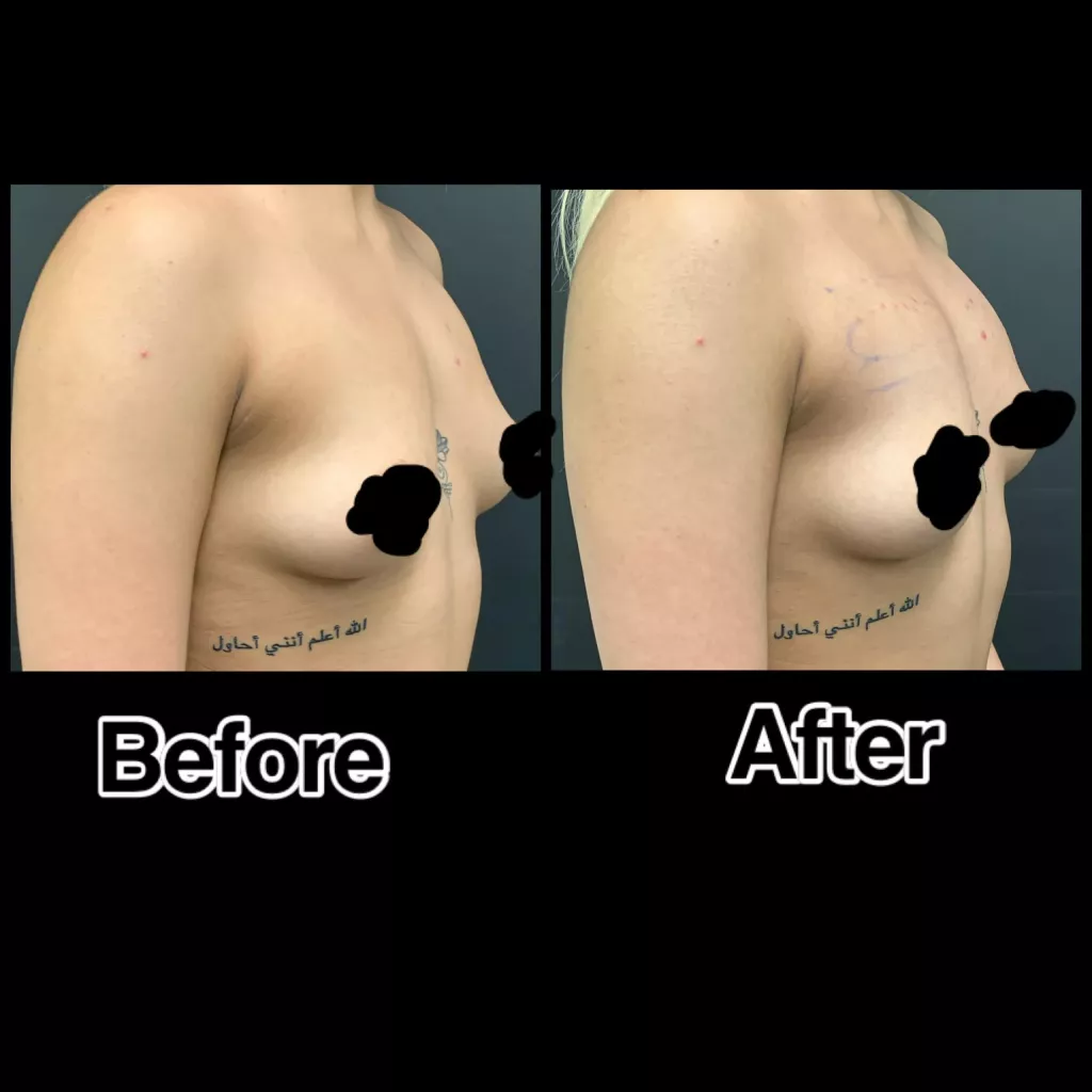 vacuum-boobs.webp